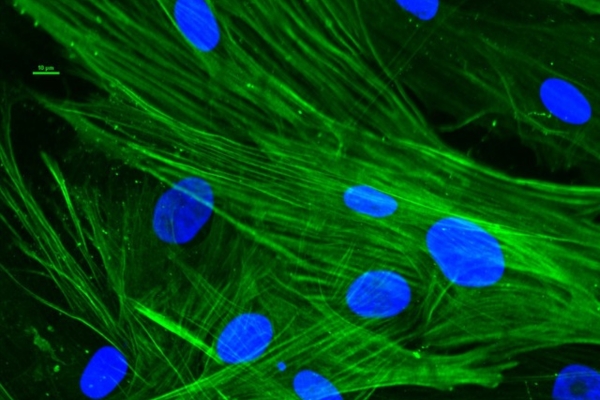 Smooth muscle cells successfully isolated. Blue indicates spots marked with dapi stain